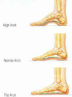 Flat Feet