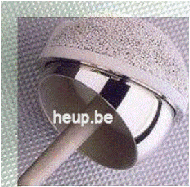 Hip Resurfacing Surgery